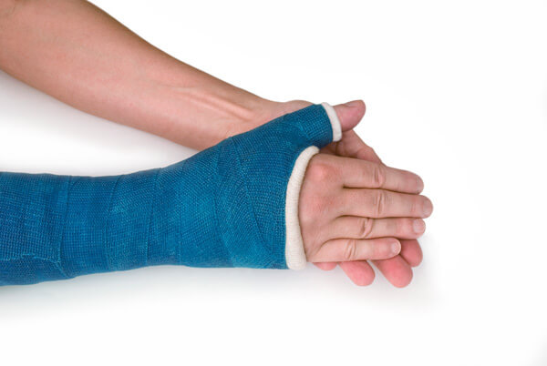 Ναρθήκας χεριού: Μια εικόνα που δείχνει έναν ναρθήκα που χρησιμοποιείται για τη στήριξη και την προστασία του χεριού, συνήθως σε περιπτώσεις τραυματισμού ή αναπηρίας
